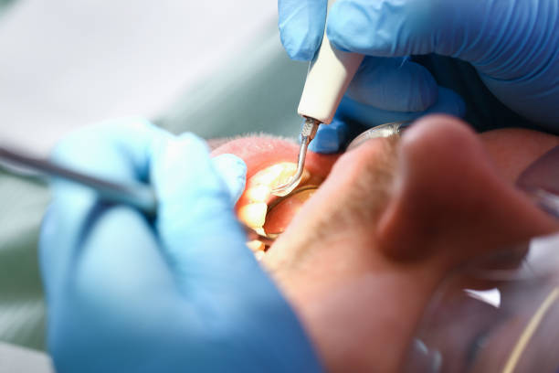 Best Emergency Denture Repair in Drain, OR